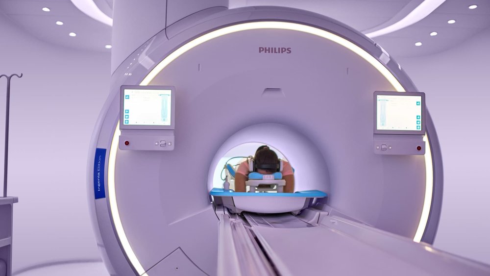 Philips presenta Ingenia Elition su nueva solución de resonancia magnética digital que realiza exploraciones hasta un 50% más rápido